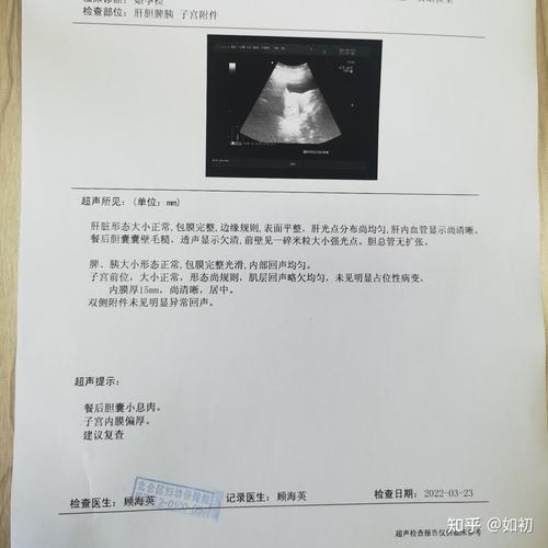 新奥今晚买什么和医生误做腹超被停工与医生误做腹超被停工怎么赔偿